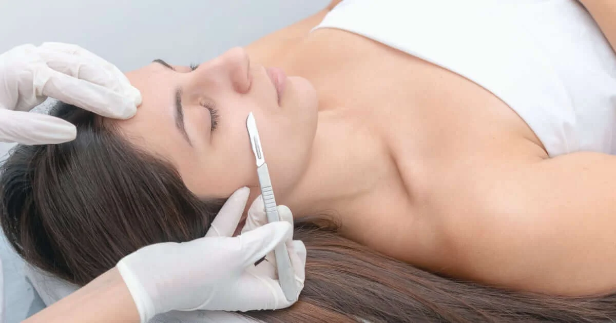 Dermaplaning