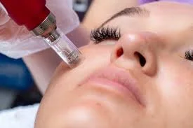 Microneedling (Dermapen)