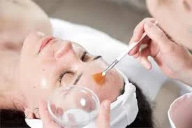 Peeling Químico
