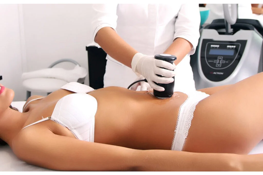 Tratamiento Ultracavitación en Maradia Estética, Buenos Aires